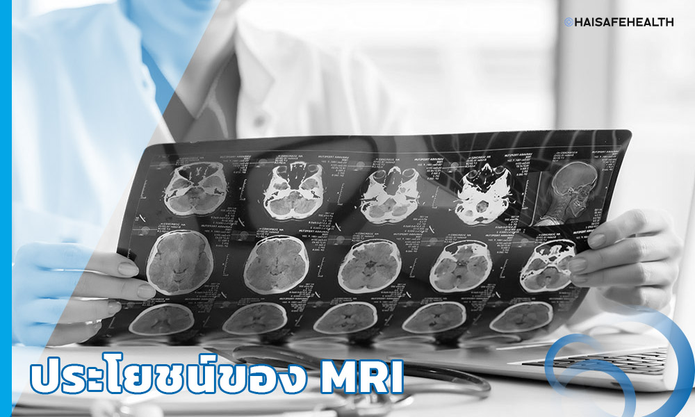 ประโยชน์ของ MRI